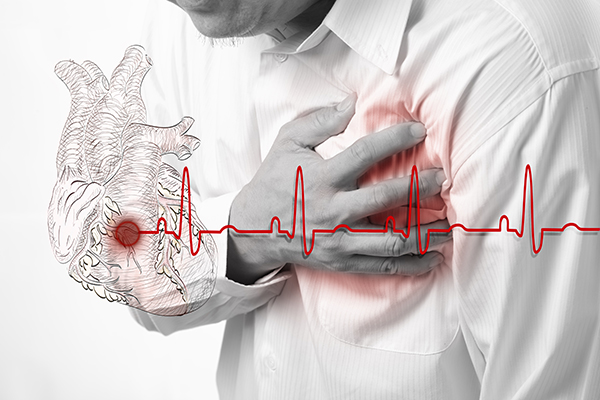 Can Medikinet Increase the Risk of Heart Attacks